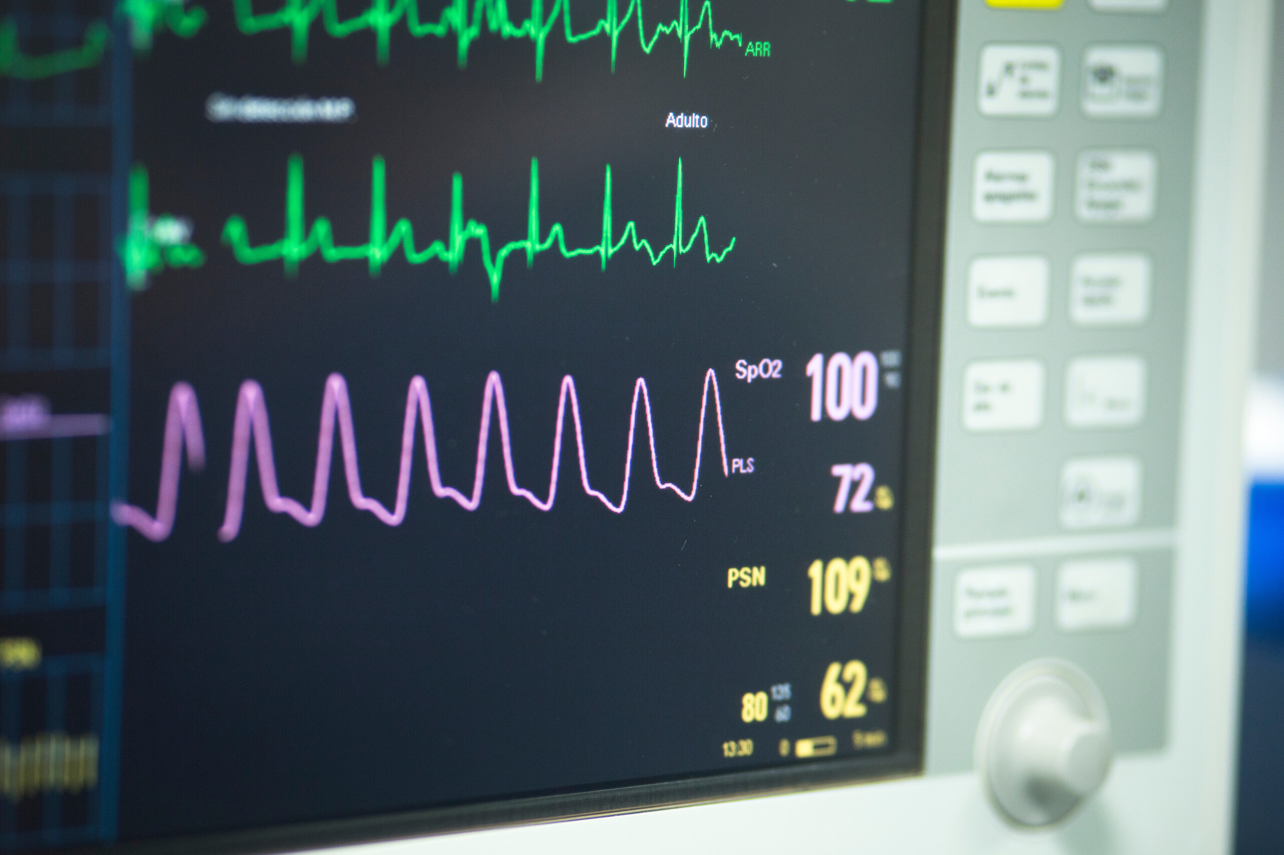 electrocardiograph