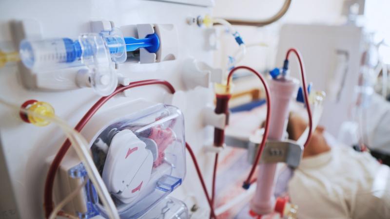 Dialysis machine circulating blood in a clinical setting